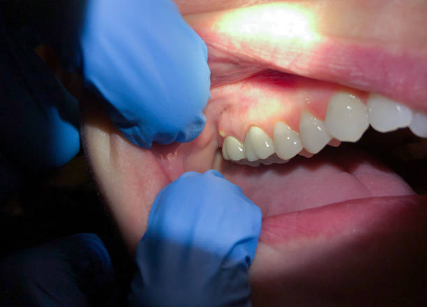 Best Cracked Tooth Emergency Dentist  in Ridgewood, IL